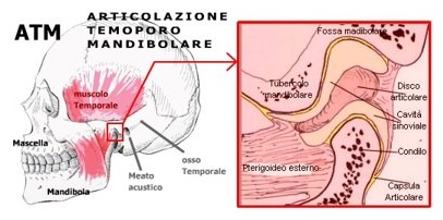 디스크 위치와 모양 도식