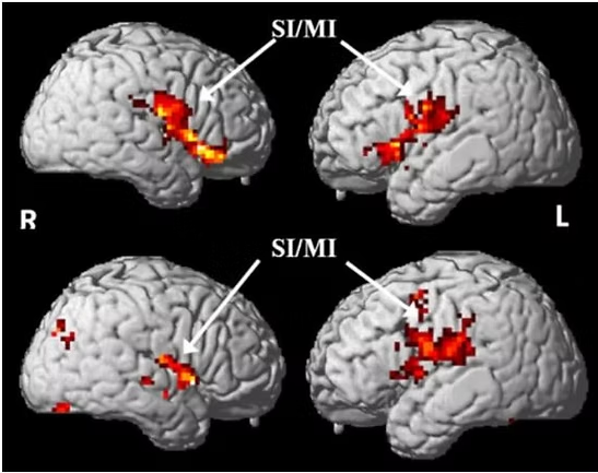 한쪽 씹기 뇌 편측화 fMRI